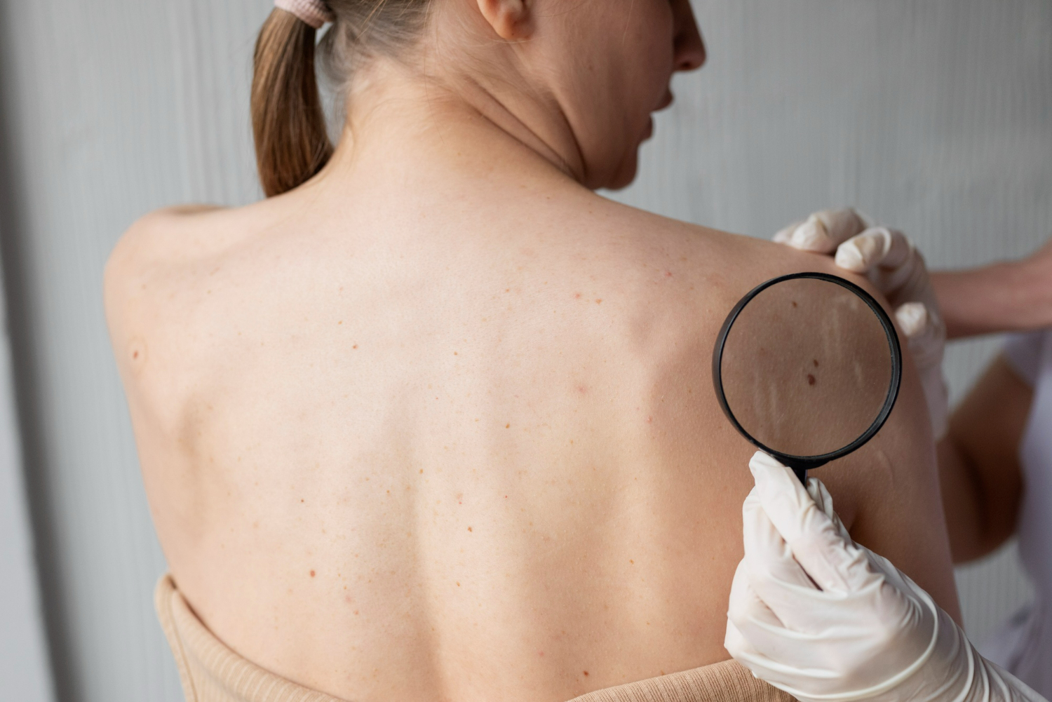 Desvendando o Câncer de Pele: Uma Investigação sobre a Dor Associada