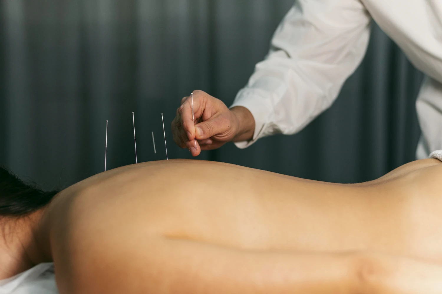 Imagem de uma sessão de diagnóstico energético na Medicina Chinesa, com agulhas acupunturais sendo aplicadas na coluna de uma pessoa.