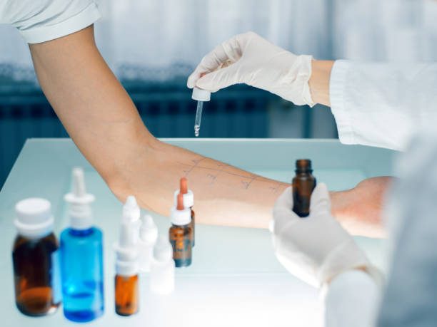 Esclareça dúvidas sobre tratamento de alergia em São Caetano do Sul e entenda como escolher a melhor abordagem.